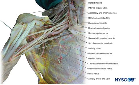 Brachial Plexus Anatomy Cadaver