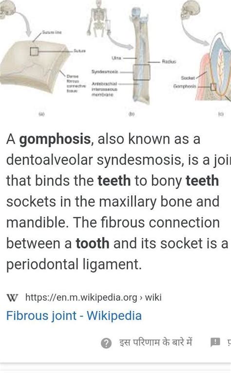 Gomophoses are characteristic feature of which type of teeth? - Brainly.in