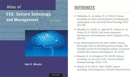 Seizure localization; based on semiology | PDF