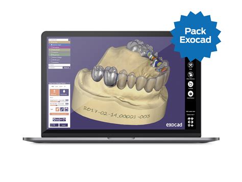 Exocad webview