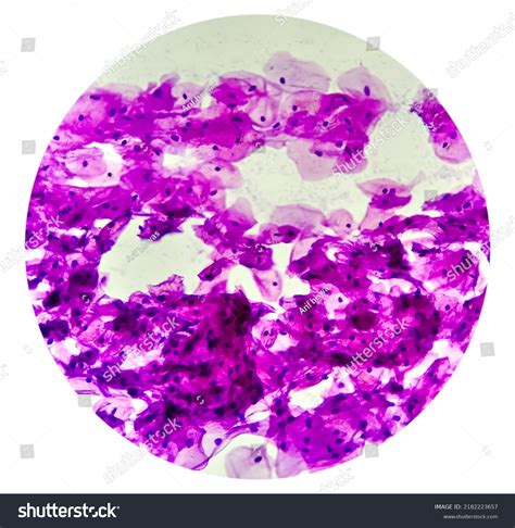 Cheek Epithelial Cells Under Microscope