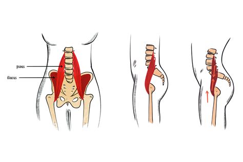 How to Fix Anterior Pelvic Tilt: 6 Exercises and Stretches