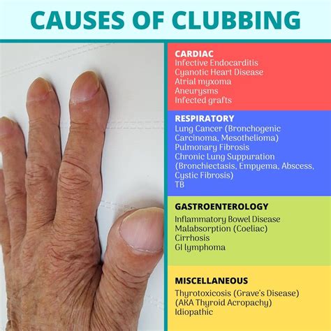 Top 100+ Pictures What Does Clubbing Of The Fingers Look Like Updated