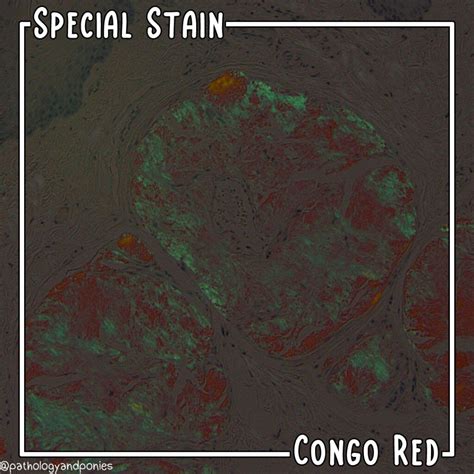 Congo Red Stain