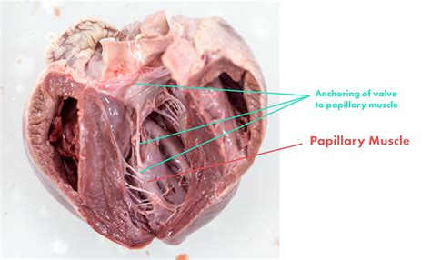 Papillary Muscles
