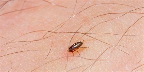 animal allergy test for humans
