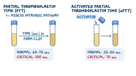 Coagulation studies - Partial thromboplastin time (PTT): Nursing: Video ...