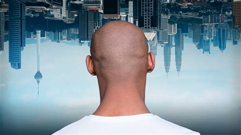 Meet Patient M, Man Who Was Shot In The Head And Started Seeing World ...