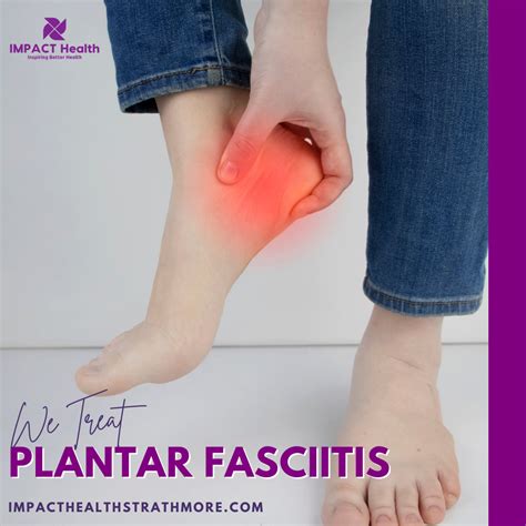 Plantar Fasciitis 的图像结果