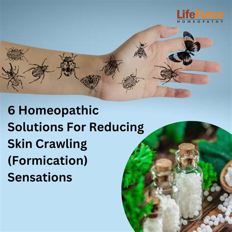 Homeopathic Solutions For Reducing Skin Crawling (Formication) Sensations