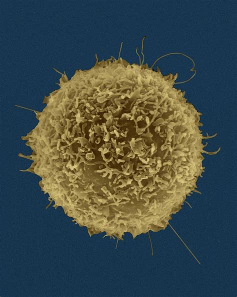 Image result for Lymphocytes Microscopic View