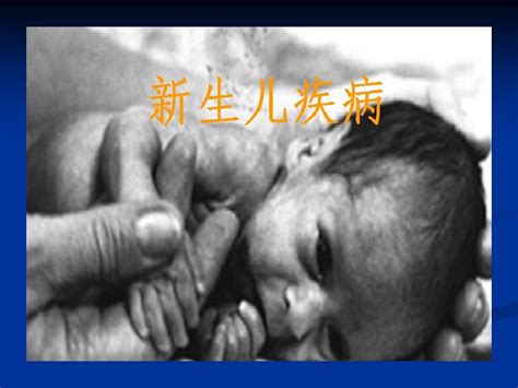 海门在南通县市区中率先开展29项新生儿遗传代谢病免费筛查_荔枝网新闻