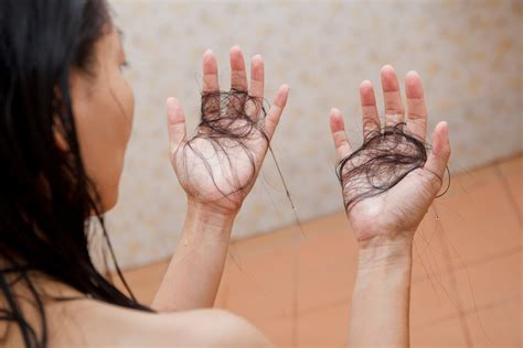Why is My Hair Falling Out? - Healthcare Associates of Texas
