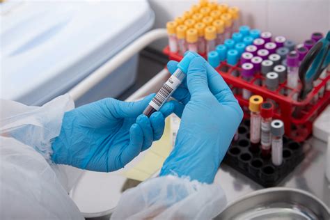 Leukemia Blood Test Results: Understanding Key Results