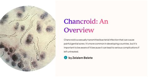Chancroid: An Overview
