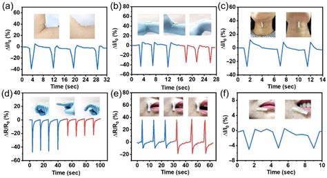 Bilayer Hydrogels for Wound Dressing and Tissue Engineering