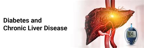 Diabetes and Chronic Liver Disease
