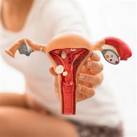 Endometriosis, Ovarian Cysts & Heavy Periods: Your Complete Guide ...