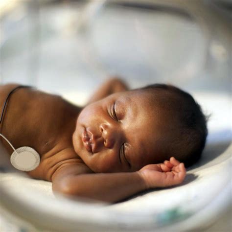 Evaluation of Pulse Rate, Oxygen Saturation, and Respiratory Effort ...