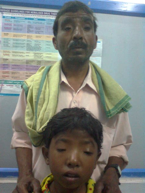 Familial ptosis | Pediatric Oncall Journal