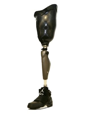Prosthetic Service Pune| Artificial Limb Pune | Orthotics Pune