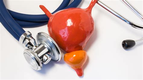 Síntomas de próstata inflamada: Todo lo que debes saber