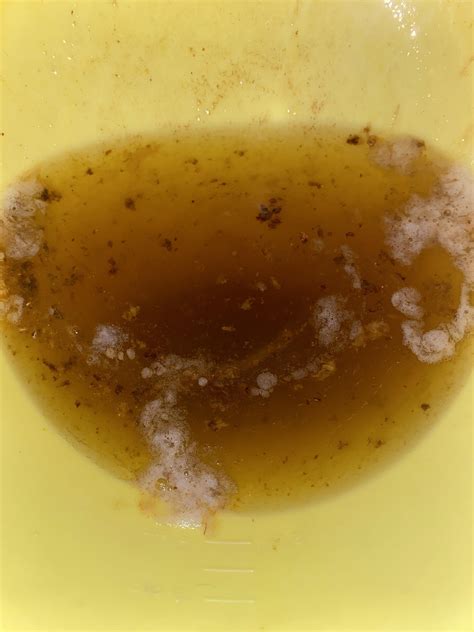 What Does It Mean When You Vomit Blood at Renee Smith blog