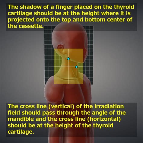 Image result for Contralateral View