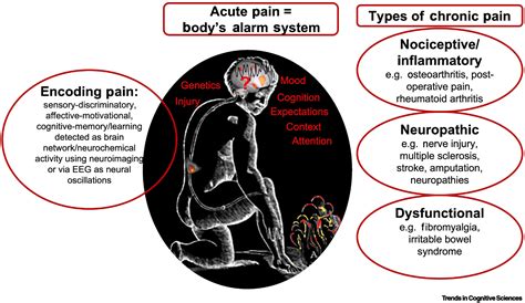 Why pain hurts: Trends in Cognitive Sciences