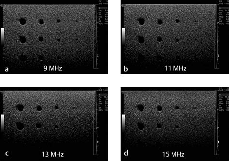 Image result for Ultrasound Lab