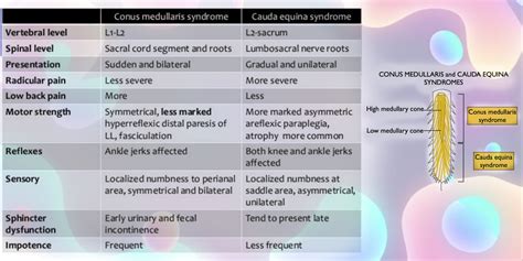 Conus Medullaris And Cauda Equina Syndrome