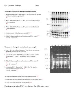 Image result for DNA Fingerprinting Worksheet Back Answer Key