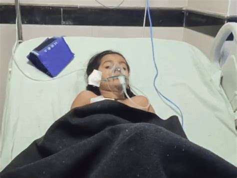 Child Badly Injured With Multiple Bites, Shifted to Kota Hospital
