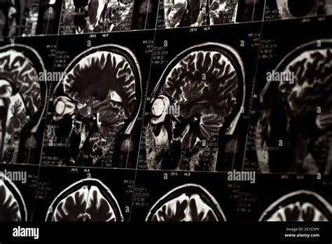 Image result for Human Brain Scan