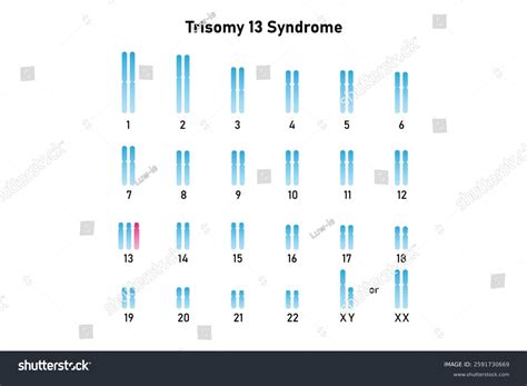 Trisomy 13 Syndrome