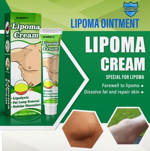 SIYDHA Lipomas Cream Cleansing Cellulite Fat Lump Removal Repair Body ...