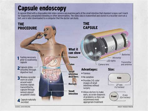 Capsule Endoscopy Belt