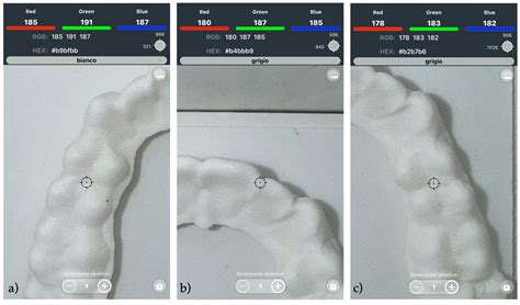 Color Variation in 3D-Printed Orthodontic Aligners as a Compliance ...
