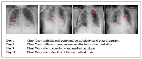 Image result for Pulse Code Modulation Usage