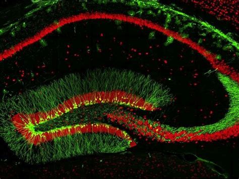 Asymptotic freedom of motion | Meer