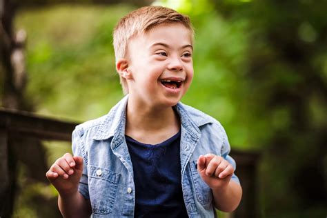 Down Syndrome: Symptoms, Causes, Prevention And Treatments – FFPKG
