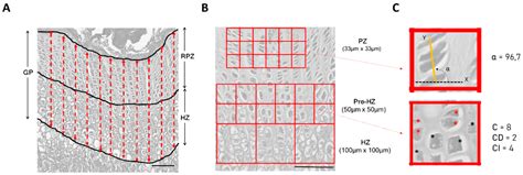 Growth Plate Pathology in the Mucopolysaccharidosis Type VI Rat Model ...