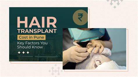 Hair Transplant Cost in Pune: Complete Price Guide & Key Factors
