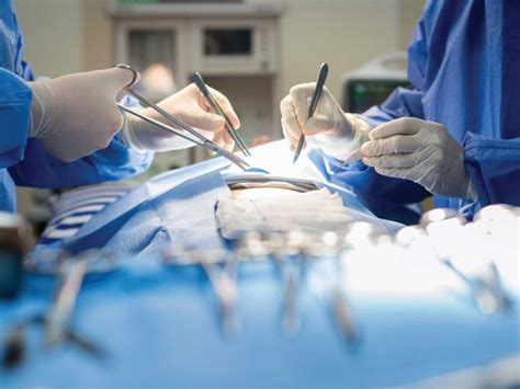 Image result for Angion Method Review