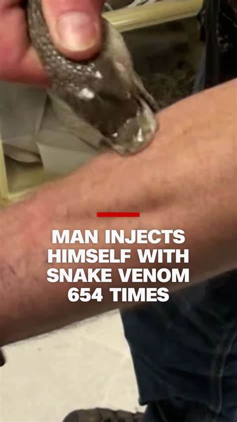 Video: Man injects himself over 600 times with snake venom | CNN