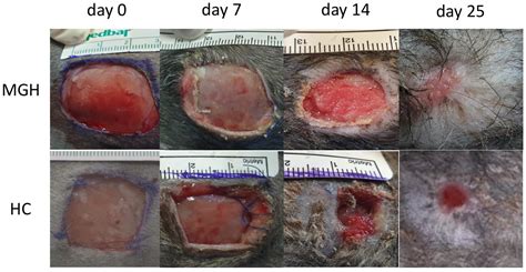 Evaluation of the Effectiveness of Medical-Grade Honey and Hypericum ...