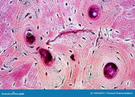 Histology of Human Compact Bone Tissue Under Microscope View for Stock ...