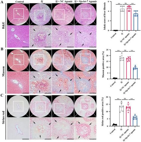 Sja-Let-7 Attenuates Carbon Tetrachloride-Induced Liver Fibrosis in a ...