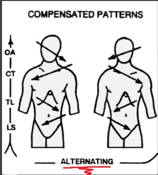 Image result for Common Compensatory Pattern