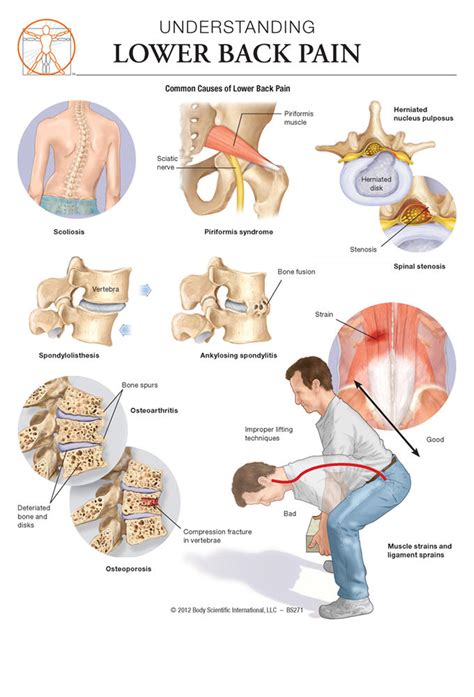 Image result for Lower Back Pain Chart